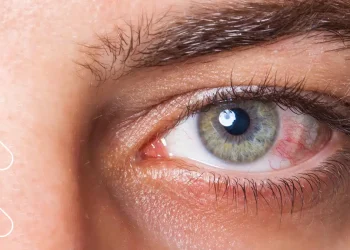 INCOCEGLA advierte que la mitad de los dominicanos con glaucoma desconoce su condición